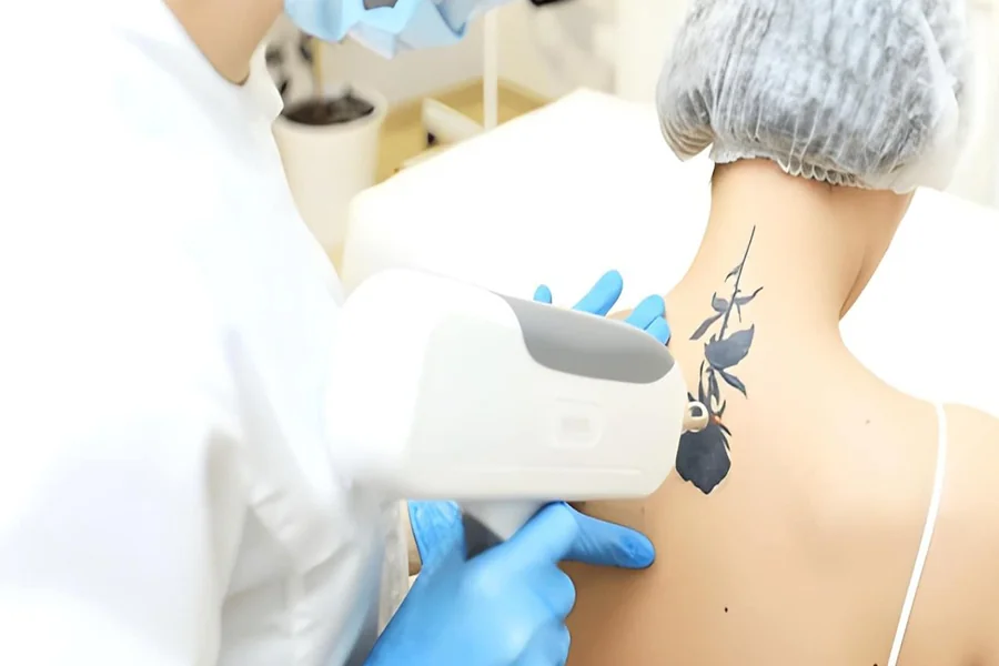 The Ultimate Tattoo Removal Guide for 2026
